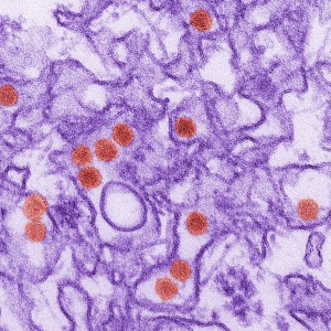 Transmission Electron Micrograph (TEM) of Zika Virus